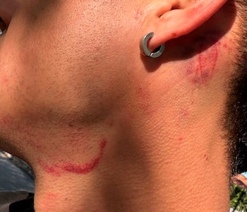 La salvaje agresión ocurrió durante