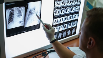 Qué es la fibrosis quística: